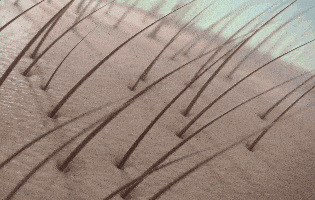 1.gif